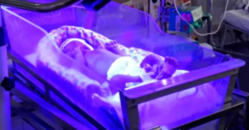 Bé trai chào đời 30 giờ phải báo động đỏ vì thay máu khẩn cấp