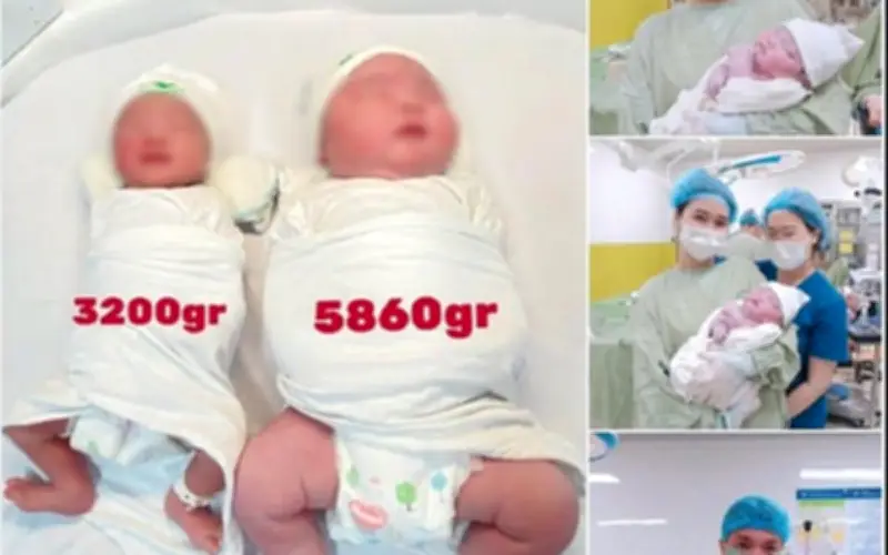 Bé trai chào đời nặng gần 6 kg tại Hà Nội, bác sĩ cảnh báo nguy cơ thai to