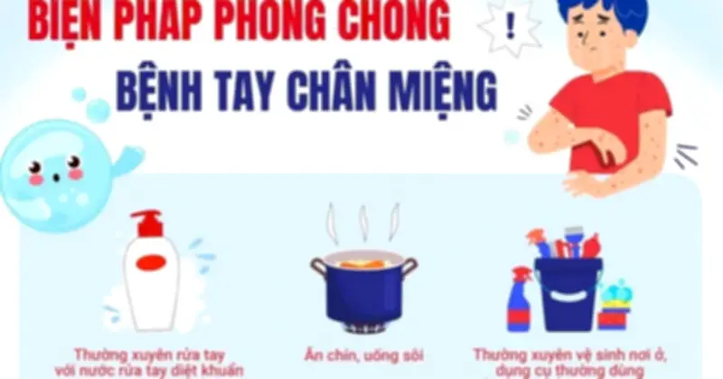 Bộ Y tế cảnh báo dịch tay chân miệng bùng phát: Hơn 25.000 ca, 4 tử vong trong 3 tháng