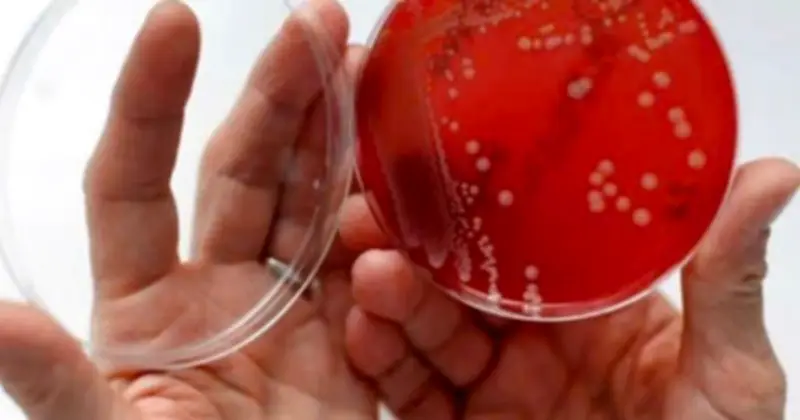 Bệnh nhân 16 tuổi ở Sơn La thoát khỏi 'siêu vi khuẩn' MRSA sau điều trị tích cực