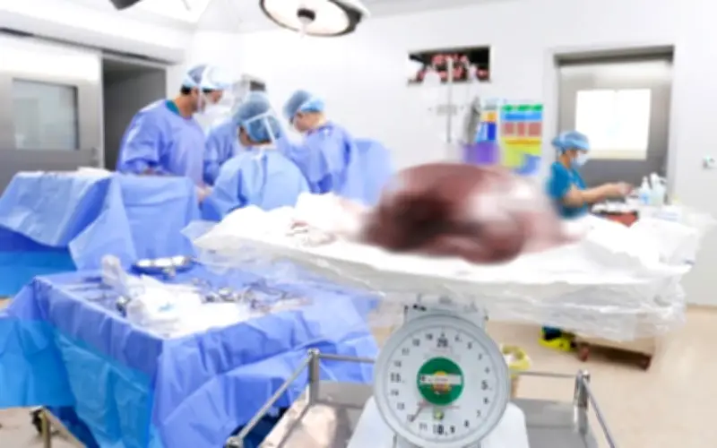 Bệnh viện Từ Dũ phẫu thuật thành công khối u xơ tử cung nặng gần 12 kg, bảo tồn tử cung