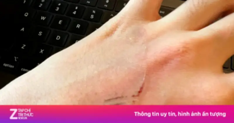 Cô gái TP.HCM bị ván gỗ rơi trúng đầu, hỏng laptop khi ngồi quán cà phê