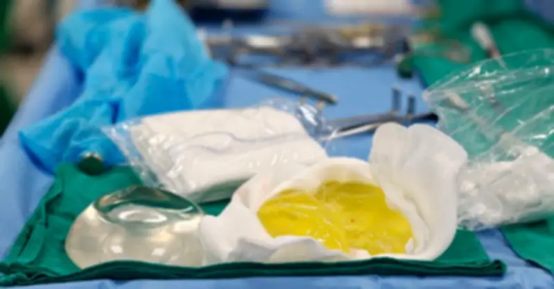 Cô gái trẻ tá hỏa vì túi ngực bất ngờ vỡ nát, cảnh báo nguy hiểm từ thẩm mỹ