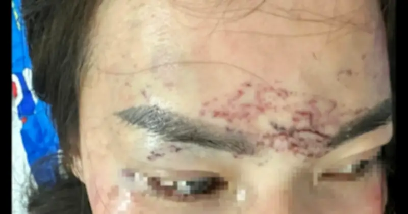 Cà Mau: Hai phụ nữ lĩnh án tù vì đánh ghen, xăm mặt nạn nhân tại cơ sở thẩm mỹ