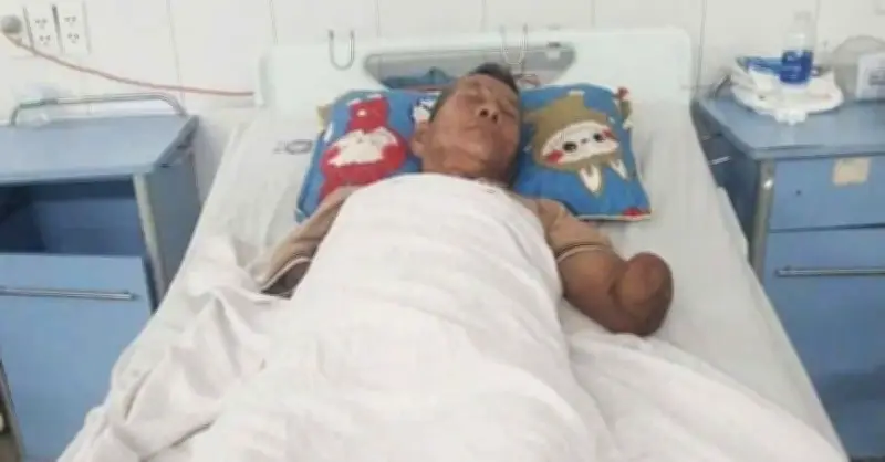 Cụ ông bị rắn hổ mang cắn, tự kẹp về nhà trong tình trạng nguy kịch