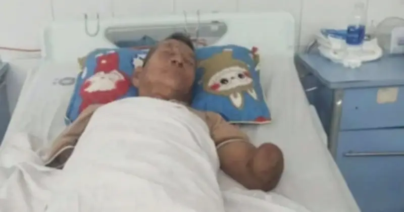 Cụ ông Đà Nẵng bị rắn hổ mang cắn vẫn kẹp rắn về nhà, sức khỏe đã ổn định