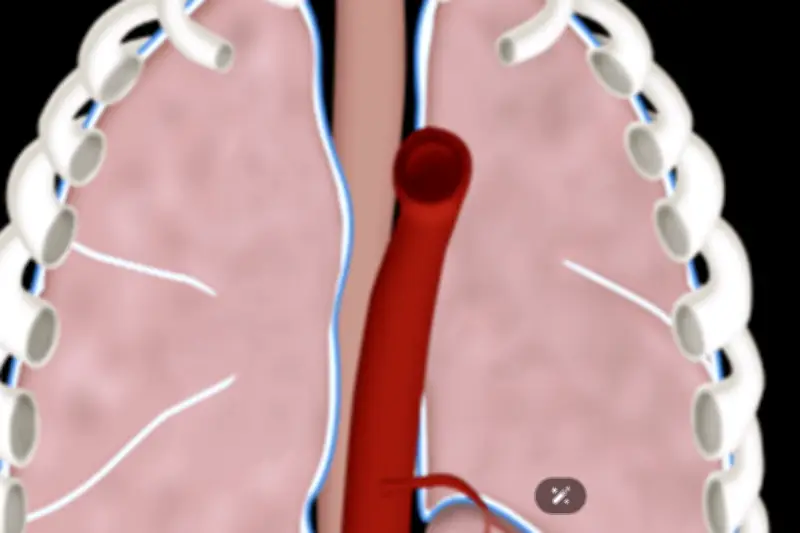 Ca phẫu thuật robot chữa bệnh hiếm gặp lần đầu tiên được thực hiện tại Việt Nam