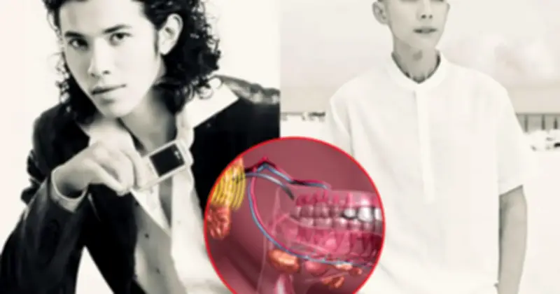 Ca sĩ Kasim Hoàng Vũ chiến đấu với u xương hàm: Hành trình gian nan và bài học cảnh báo