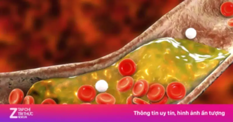 Cách Hạ Mỡ Máu Tự Nhiên: Duy Trì Lối Sống Lành Mạnh Để Bảo Vệ Tim Mạch