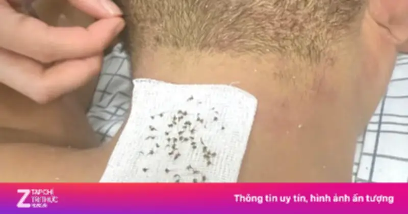 Cha Con Phú Thọ Nguy Kịch Sau Khi Bị Hàng Trăm Con Ong Tấn Công Trên Đồi