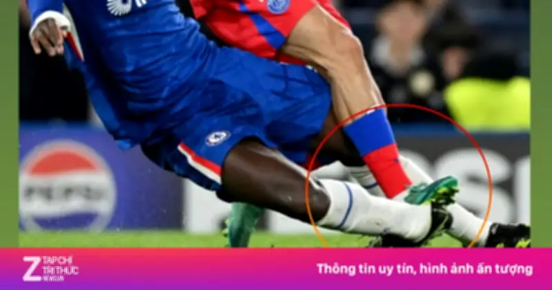 Chalobah bàng hoàng khi cổ chân lật ngược, Chelsea khủng hoảng lực lượng