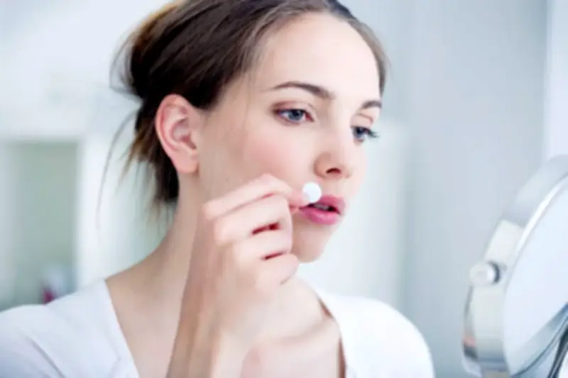 Chuyên gia cảnh báo: Dùng miếng dán mụn sau khi nặn có thể gây hại da