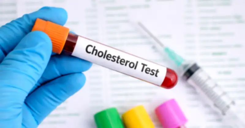 Cảnh báo: Dấu hiệu ở mắt có thể tiết lộ tình trạng mỡ máu cao nguy hiểm