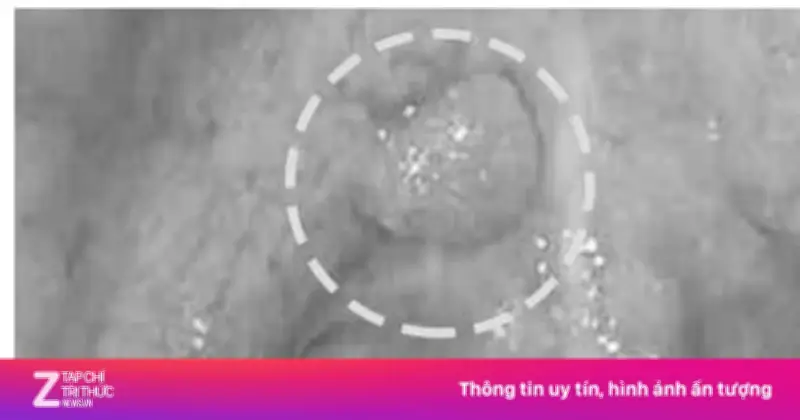 Cảnh báo dấu hiệu sớm ung thư khoang miệng: Đừng bỏ qua những thay đổi nhỏ