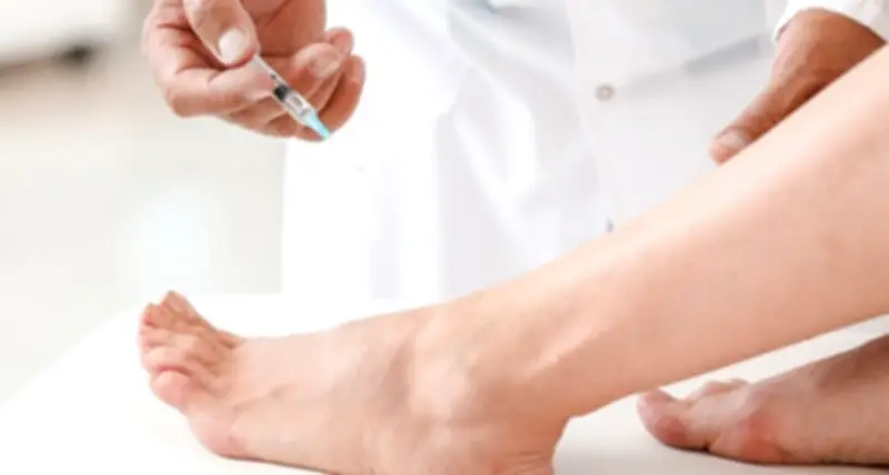 Cảnh báo: Nguy cơ hoại tử chân sau khi tiêm filler tại nhà, bác sĩ khẩn cấp cứu chữa