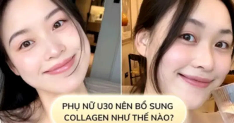 Cảnh báo: Sau 25 tuổi, cơ thể bắt đầu suy giảm collagen - Làm sao để bổ sung hiệu quả?