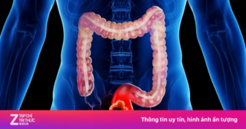 Cảnh báo ung thư dạ dày và đại tràng từ dấu hiệu âm thầm dễ bỏ qua
