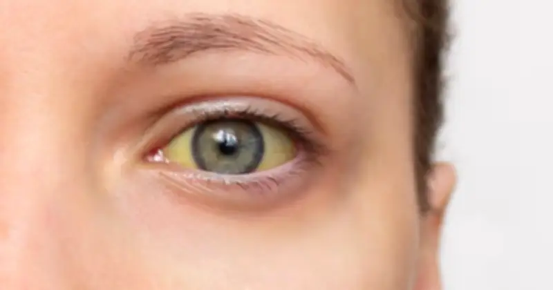 Cảnh Báo Ung Thư Tuyến Tụy: 4 Triệu Chứng 'Sát Thủ Thầm Lặng' Cần Đặc Biệt Chú Ý