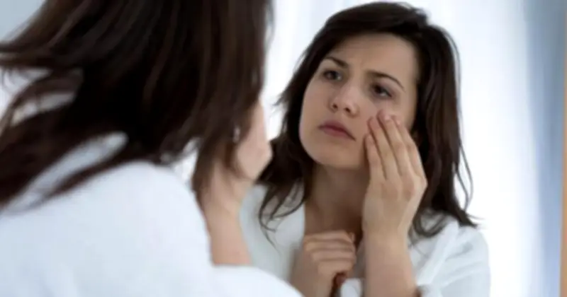 Cảnh báo y tế: 4 dấu hiệu trên khuôn mặt có thể là tiếng chuông báo động bệnh mãn tính