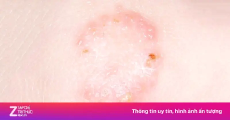 Cảnh giác nấm da lây từ chó, mèo: Nguy cơ tiềm ẩn từ vật nuôi