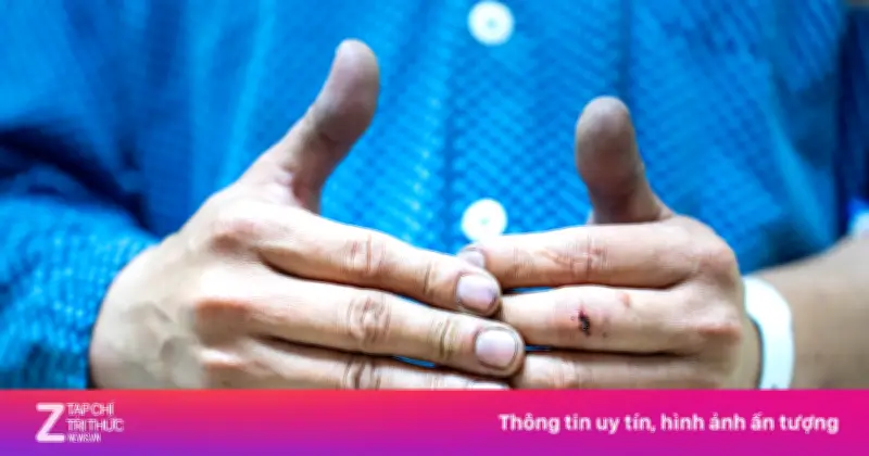 Con rể dũng cảm lao vào đám cháy cứu bố mẹ vợ, đôi tay ám muội than