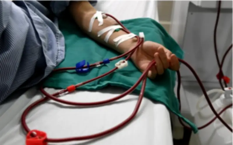 Dấu hiệu suy thận giai đoạn sớm dễ bị bỏ qua, bác sĩ cảnh báo người Việt cần cảnh giác