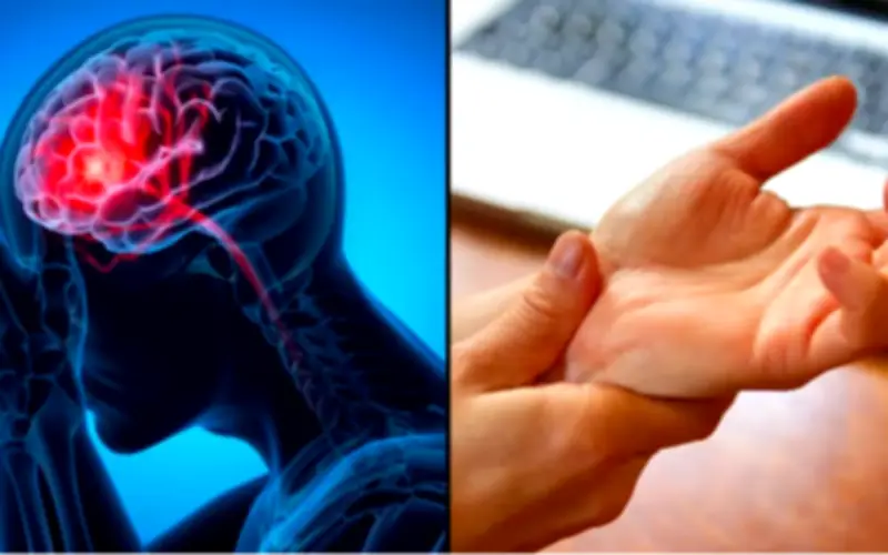 Dấu hiệu đột quỵ nguy hiểm nhất không phải tê tay chân, nhiều người Việt hiểu lầm