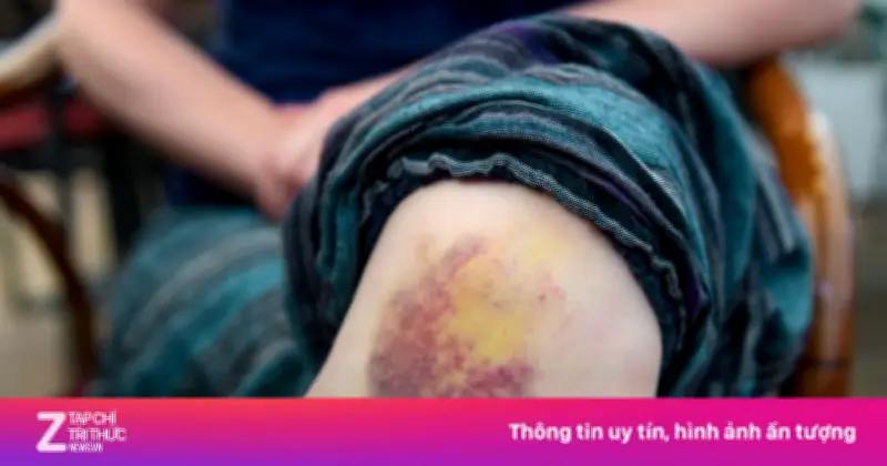 Dấu hiệu trên da cảnh báo bệnh gan: Ngứa, vàng da, vết thương chậm lành