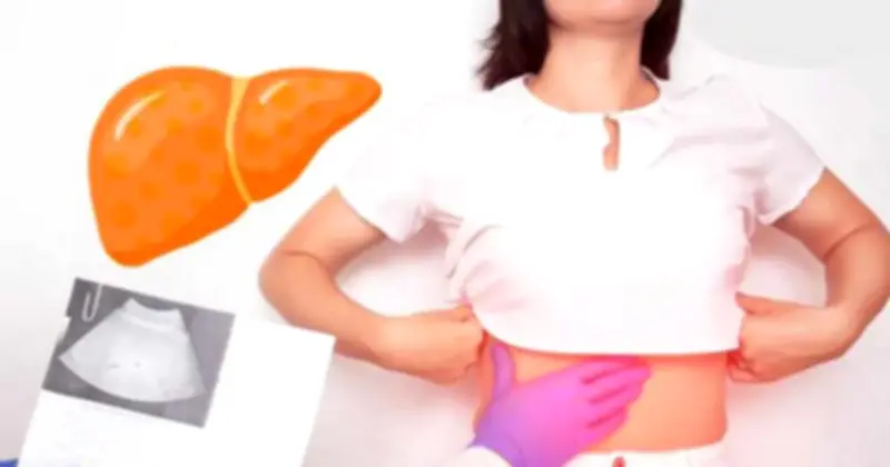 Gan Nhiễm Mỡ: Yếu Tố Tâm Lý Quan Trọng Thường Bị Bỏ Qua Trong Điều Trị