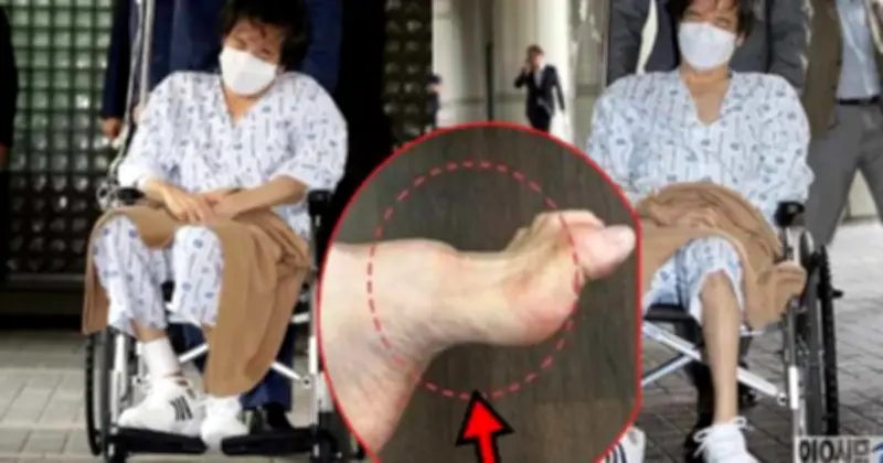 Gia tộc Samsung và căn bệnh di truyền hiếm gặp Charcot-Marie-Tooth