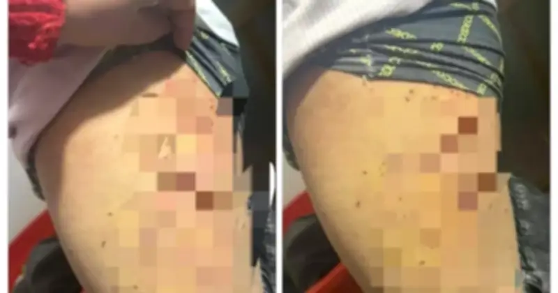 Học sinh Lào Cai bị bạn dùng bút bi đâm nhiều lần do tranh chấp chỗ ngồi