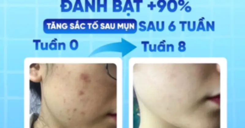 Kem Mờ Sẹo Scar Esthetique: Bí Quyết Làm Đẹp Da Được Chuyên Gia Tin Dùng