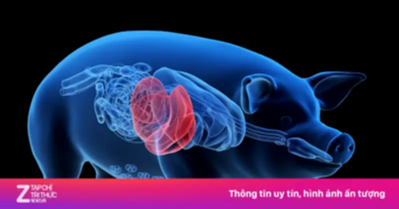 Lần Đầu Tiên Ghép Gan Lợn Biến Đổi Gene Cứu Sống Bệnh Nhân Suy Gan Chờ Ghép Tạng