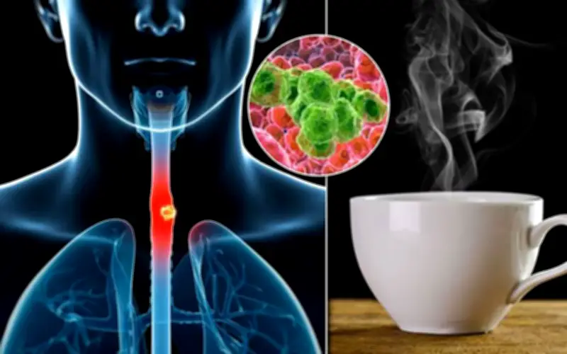 Loại Nước Uống Vô Tình Nuôi Tế Bào Ung Thư: Nhiều Người Việt Vẫn Dùng Hàng Ngày