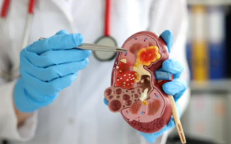 Loại rau ngon bổ nhưng tăng gánh nặng cho thận, người bệnh suy thận cần biết để tránh