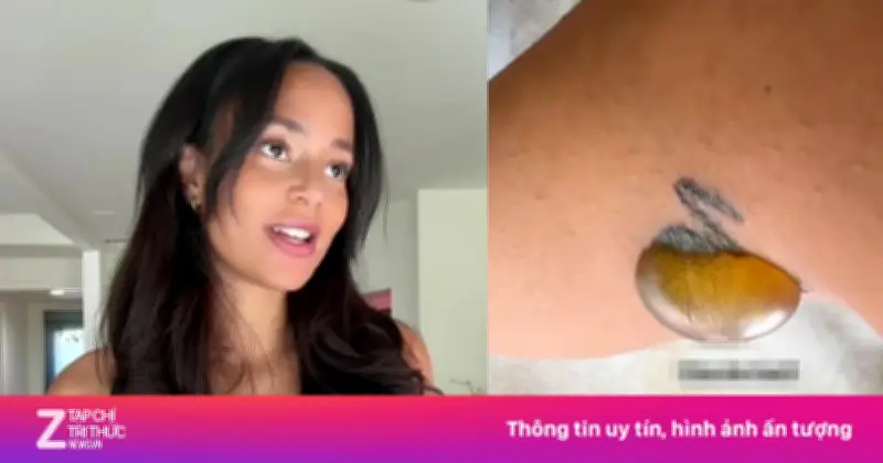 Nữ KOL Hoảng Sợ Kêu Cứu Sau Biến Chứng 'Kinh Tởm' Khi Xóa Hình Xăm