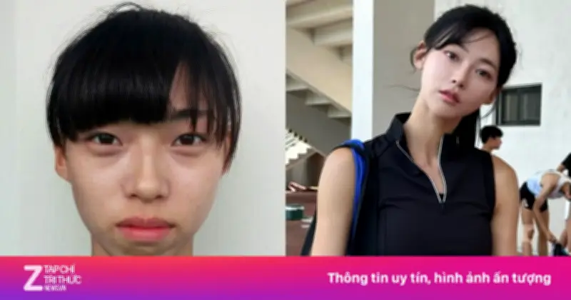 Nữ Thần Điền Kinh Kim Min Gee Lên Tiếng Về Nghi Vấn Dao Kéo Sau Ảnh Quá Khứ