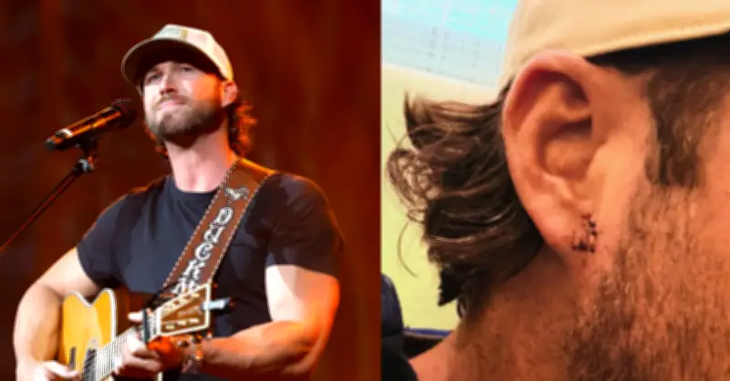 Nam ca sĩ bị chảy máu 5 mũi khâu vì khán giả ném điện thoại rách tai