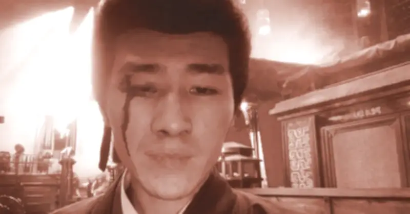 Nam Diễn Viên Tô Đoan: Hành Trình Phục Hồi Sau Tai Nạn Rách Mặt, Khâu 6 Mũi