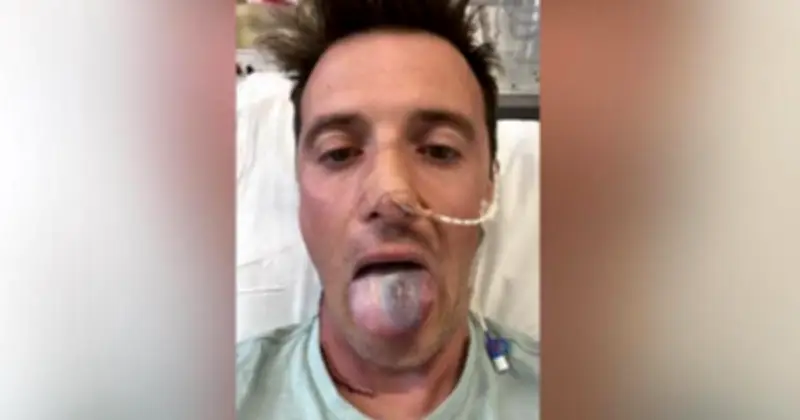 Nam giới mắc ung thư đầu cổ do HPV: Câu chuyện cảnh tỉnh về phòng ngừa