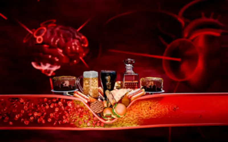 Người có cholesterol cao cần tránh những loại thực phẩm nào?