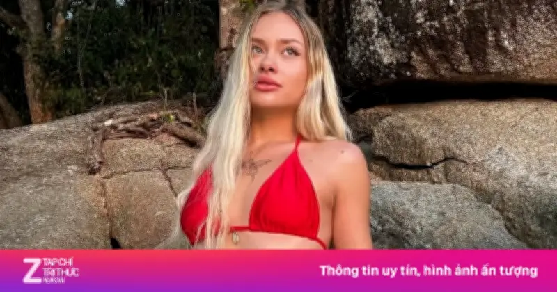 Người mẫu Ukraine hồi phục thần kỳ sau biến cố bị ném vệ đường ở Dubai