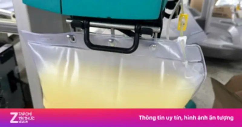 Người đàn ông 33 tuổi suýt tử vong vì viêm tụy cấp sau khi uống rượu, huyết tương trắng đục