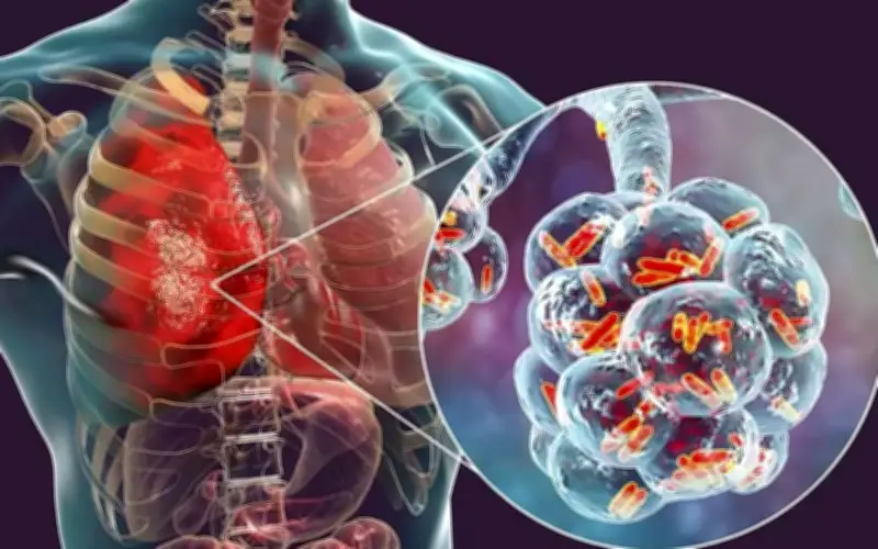 Người đàn ông 60 tuổi phát hiện sớm ung thư phổi hiếm gặp nhờ thói quen đơn giản