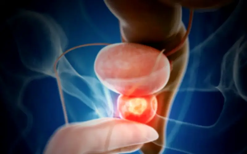 Người đàn ông 68 tuổi phát hiện ung thư tuyến tiền liệt từ dấu hiệu nhiều nam giới Việt bỏ qua