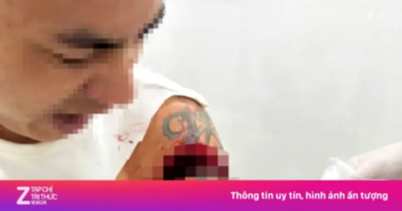 Người đàn ông bị chém trọng thương khi đang uống cà phê ở Nghệ An