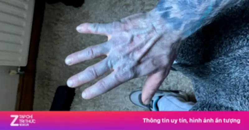 Người Đàn Ông Da Xanh Như Avatar Vì Ga Giường Mới Chưa Giặt