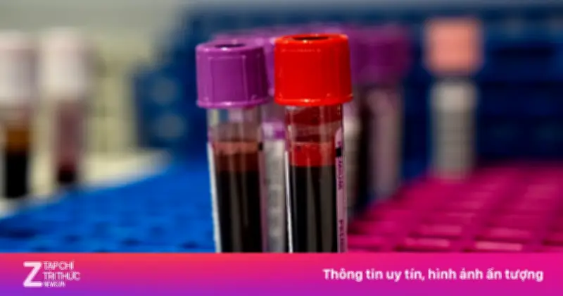 Người Nhật 'Kỳ Thị' Nhóm Máu B: Định Kiến Văn Hóa Hay Khoa Học?