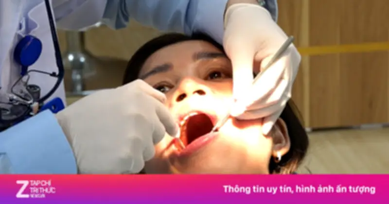 Nên lấy cao răng bao lâu một lần? Lời khuyên từ chuyên gia nha khoa