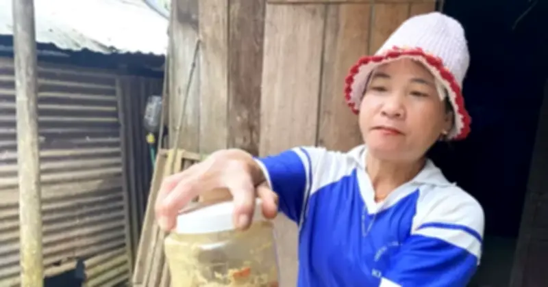 Đà Nẵng: Ba trẻ ngộ độc Botulinum từ cá ủ chua, may mắn được cứu sống nhờ thuốc hiếm